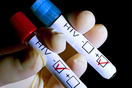 Betrug mit teuren HIV-Medikamenten scheint lukrativ (Foto: Sebastian Czapnik | Dreamstime.com)