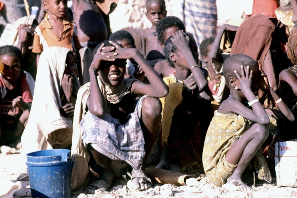 Hungernde Kinder in Somalia, dts Nachrichtenagentur