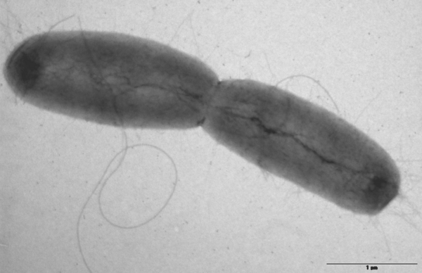 E.coli-Bakterien, Bundesinstitut für Risikobewertung, über dts Nachrichtenagentur