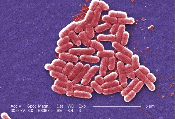 Foto: Enterohämorrhagische Escherichia coli (EHEC), CDC, über dts Nachrichtenagentur