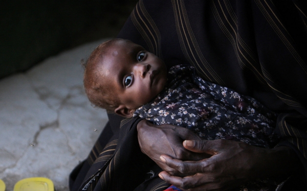 Hungerndes Kind in Somalia, UN Photo/Stuart Price, über dts Nachrichtenagentur