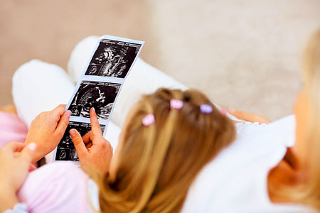 CDU stimmt für Verbot von Tests an Embryonen