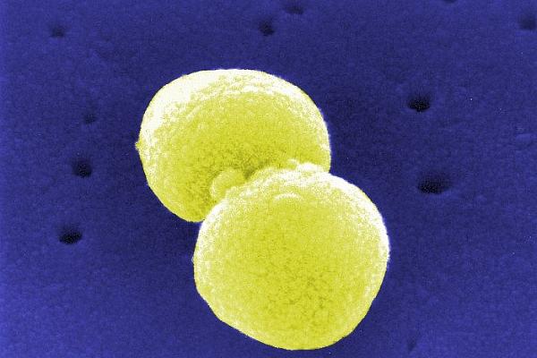 Streptococcus pneumoniae (Archiv), via dts Nachrichtenagentur